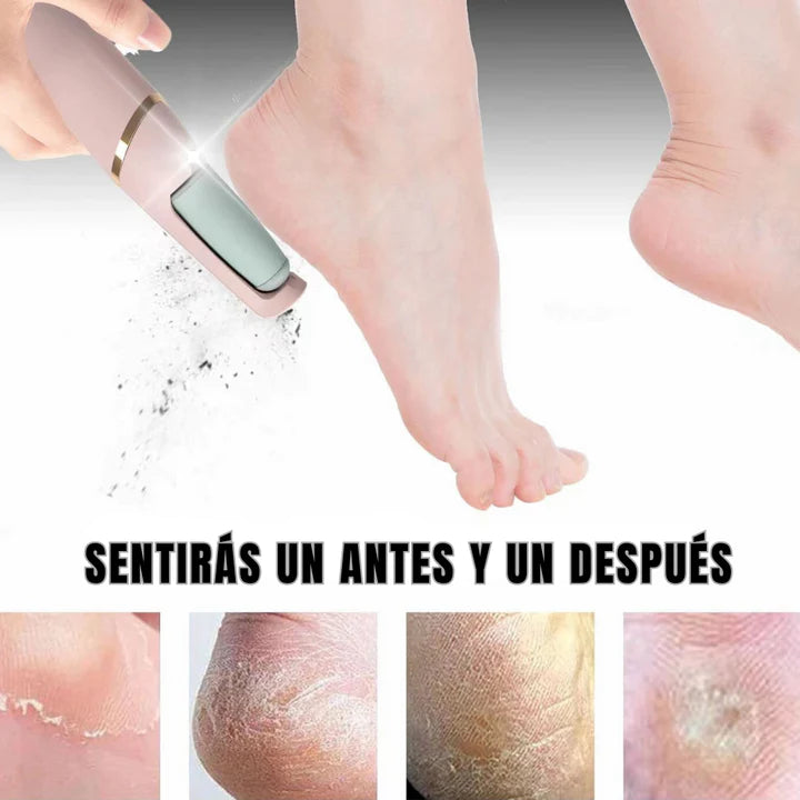 Removedor de Callos (Recargable🤩) + Envío Gratis⭐⭐⭐⭐